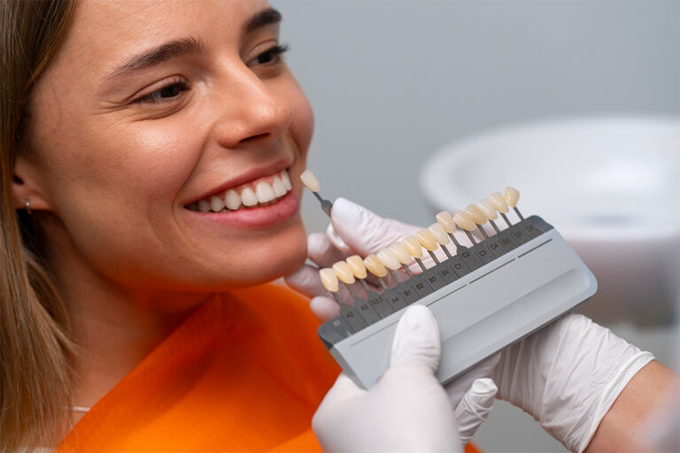 Laminates & Veneers